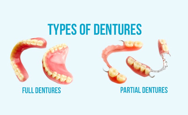 Different Types Of Dentures Harristown IL 62537